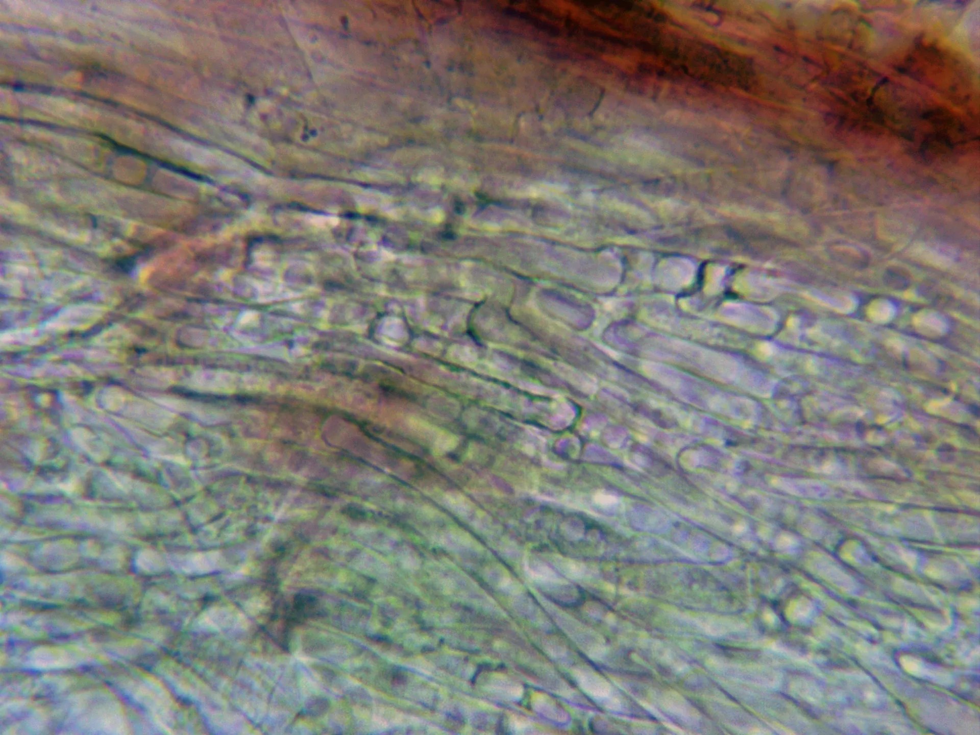 Microscopía de Pleurotus ostreatus - 15 - Cutícula